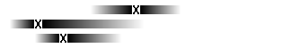 Diagram Hj&auml;rntum&ouml;r hos barn