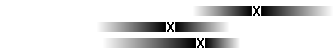 Diagram Hj&auml;rntum&ouml;r hos vuxna