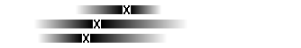 Diagram Hj&auml;rtsjukdomar